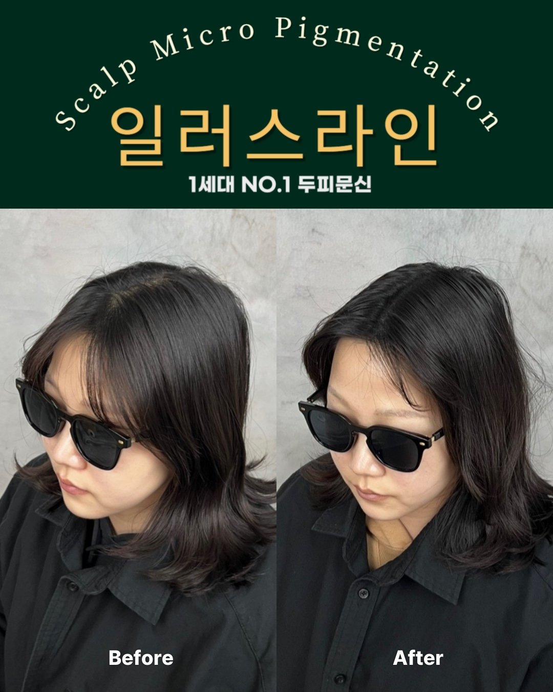 시술사례 이미지