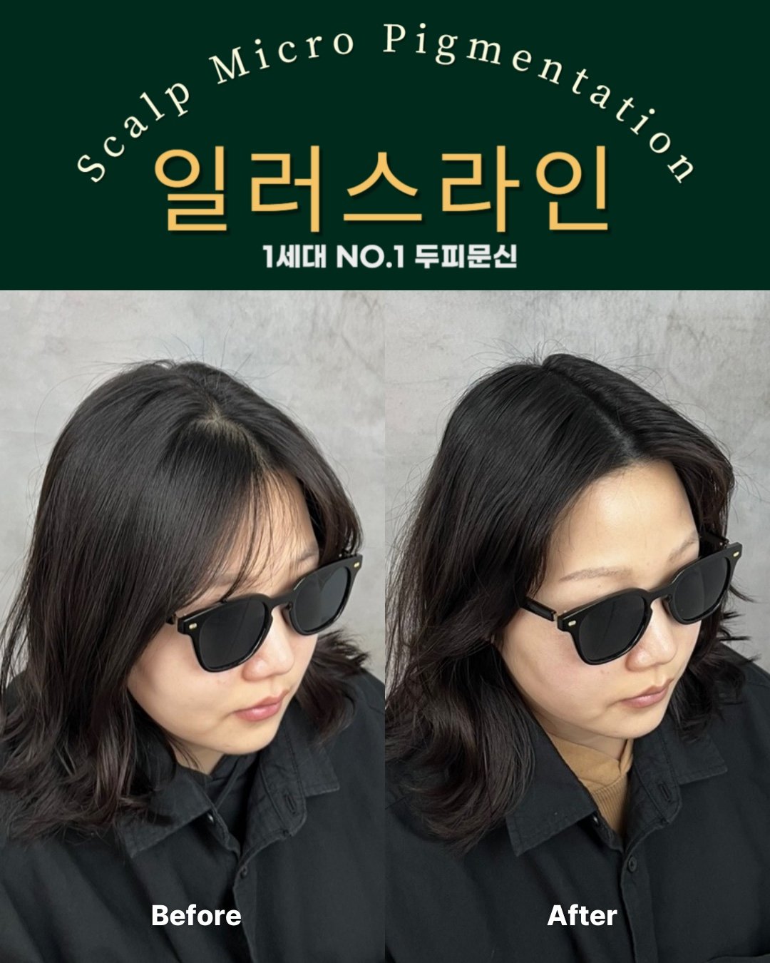 시술사례 이미지