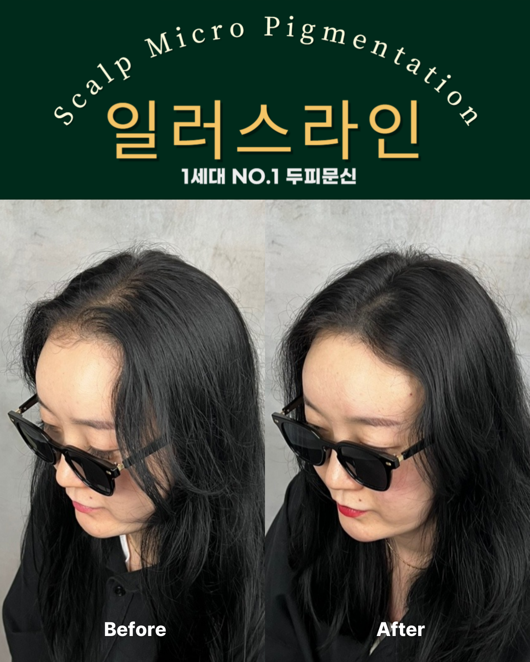 시술사례 이미지