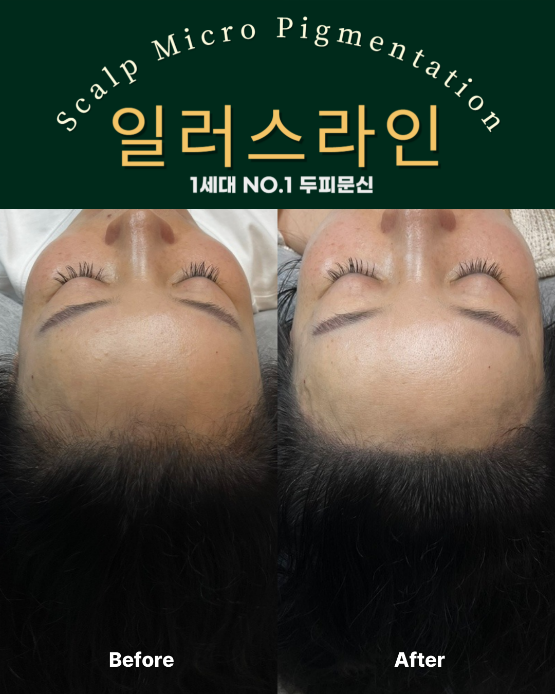 시술사례 이미지