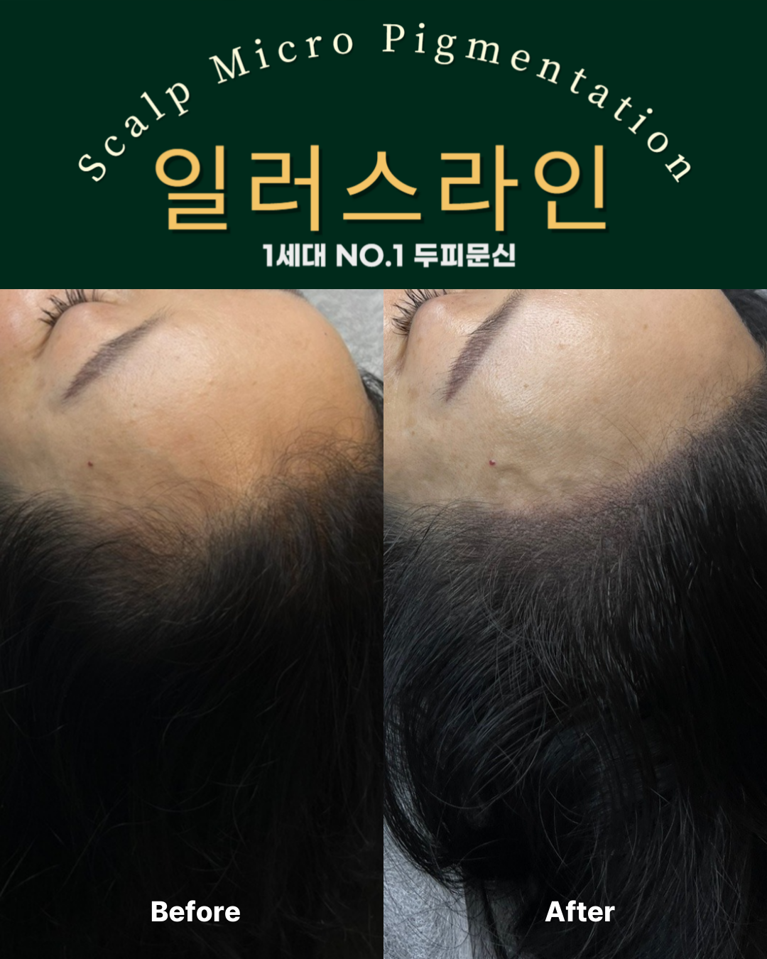 시술사례 이미지