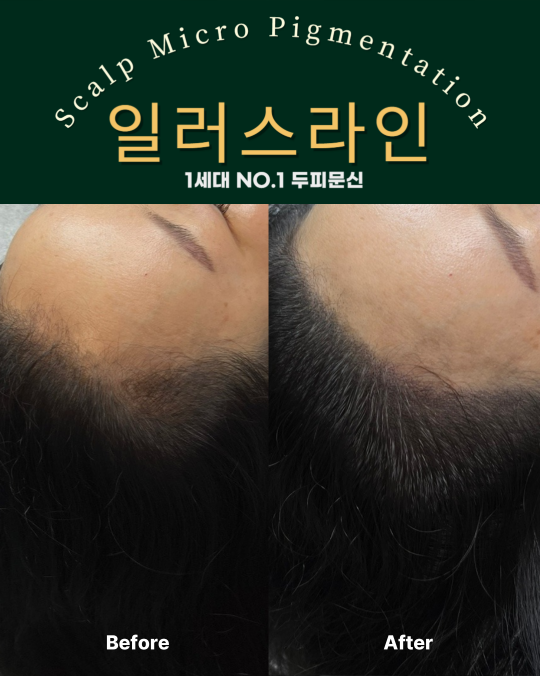 시술사례 이미지