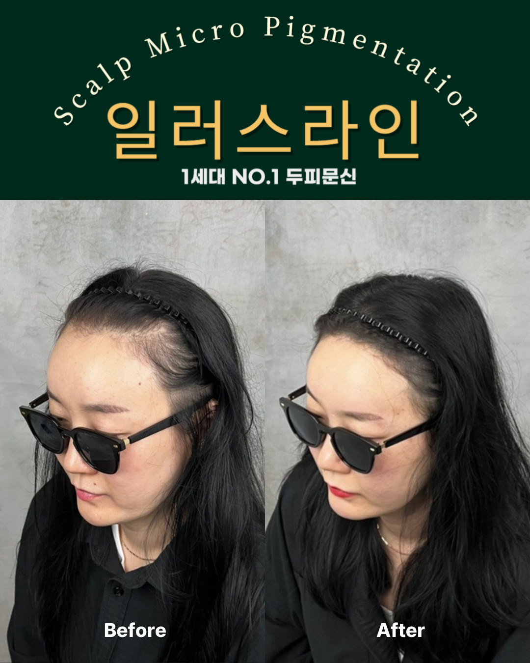 시술사례 이미지