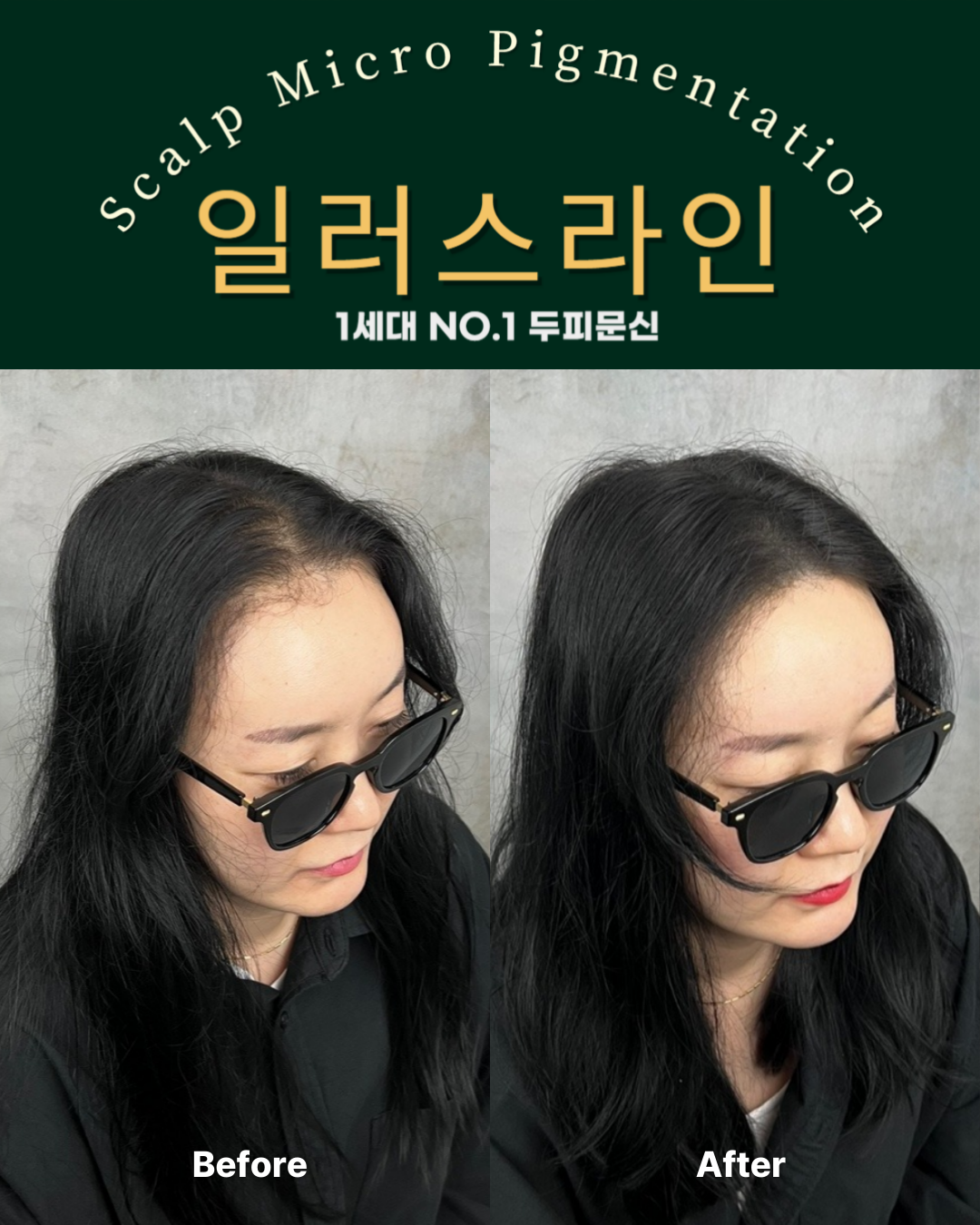 시술사례 이미지