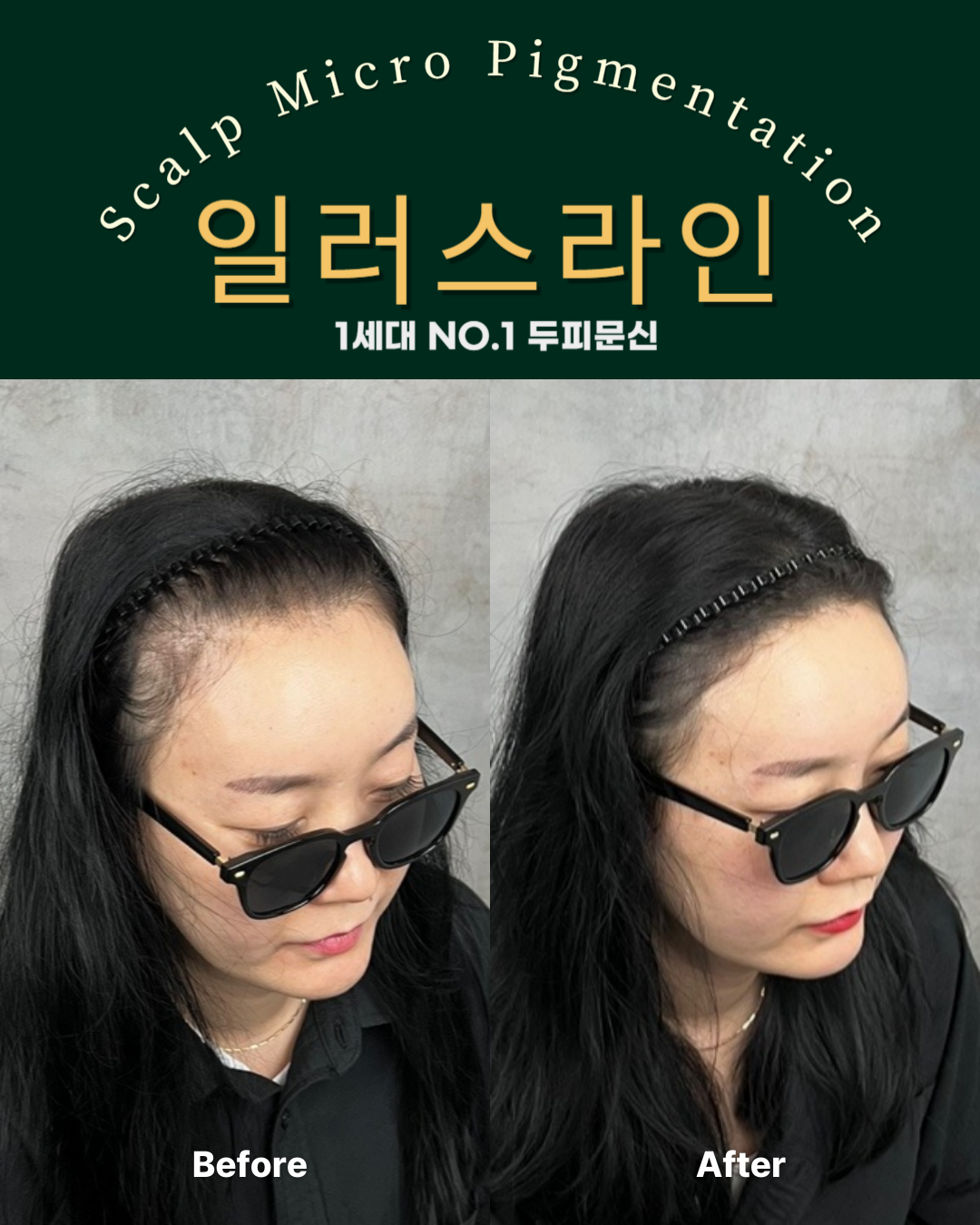 시술사례 이미지
