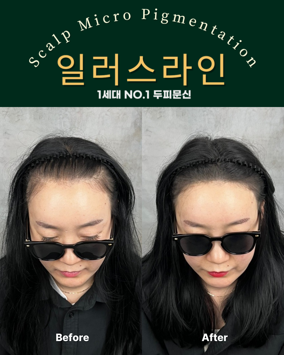 시술사례 이미지