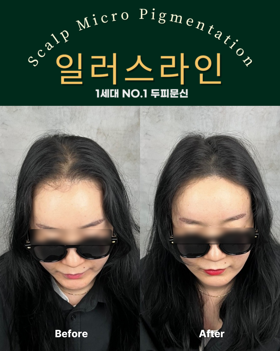 시술사례 이미지