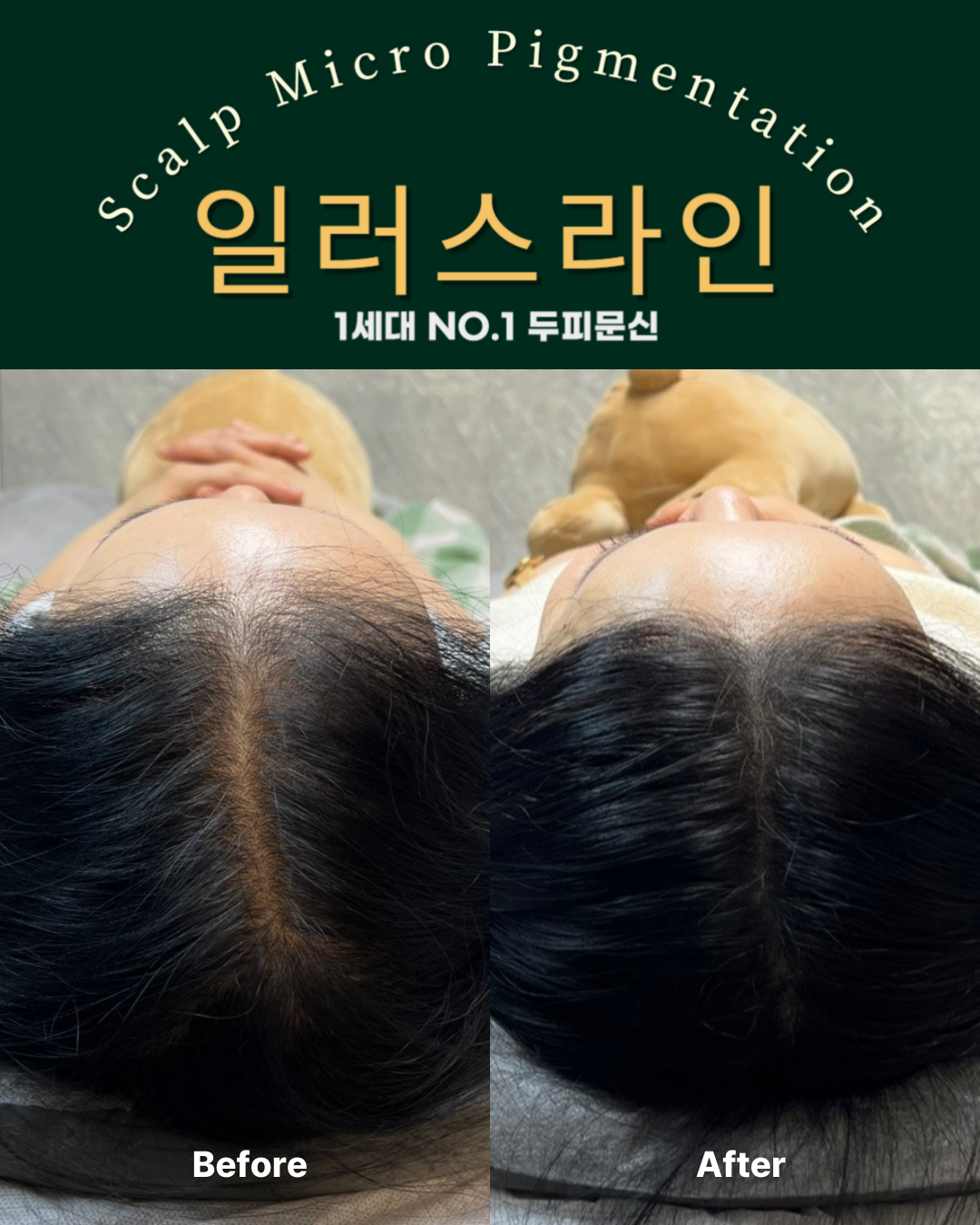 시술사례 이미지
