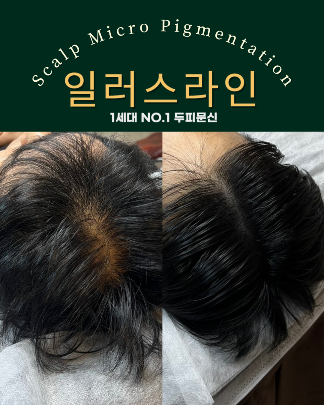 시술사례 이미지