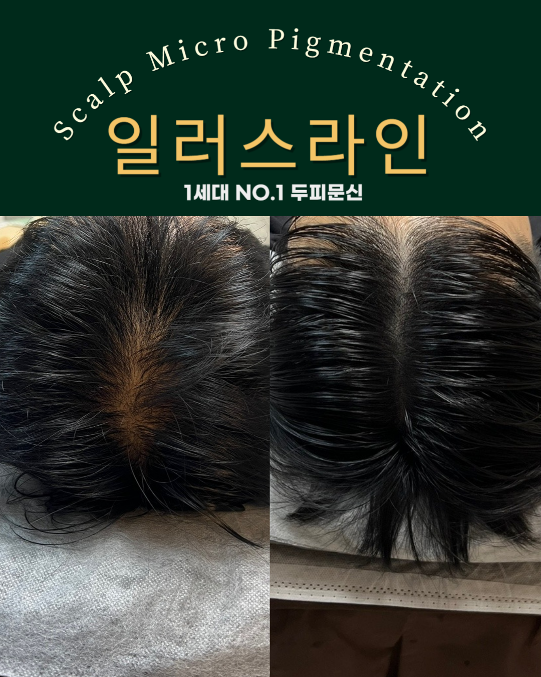 시술사례 이미지