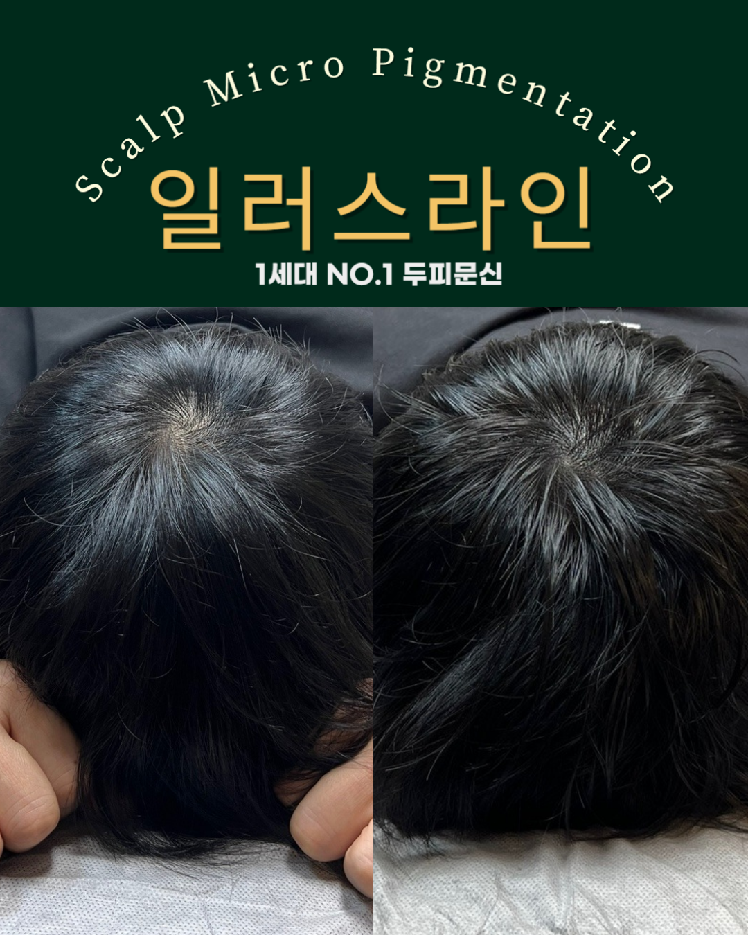 시술사례 이미지