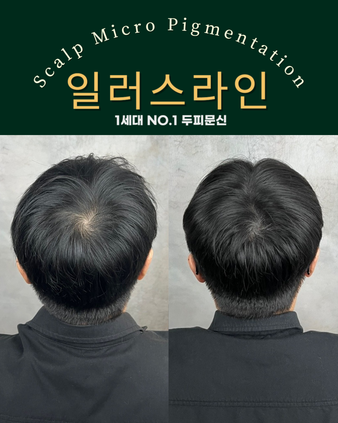 시술사례 이미지