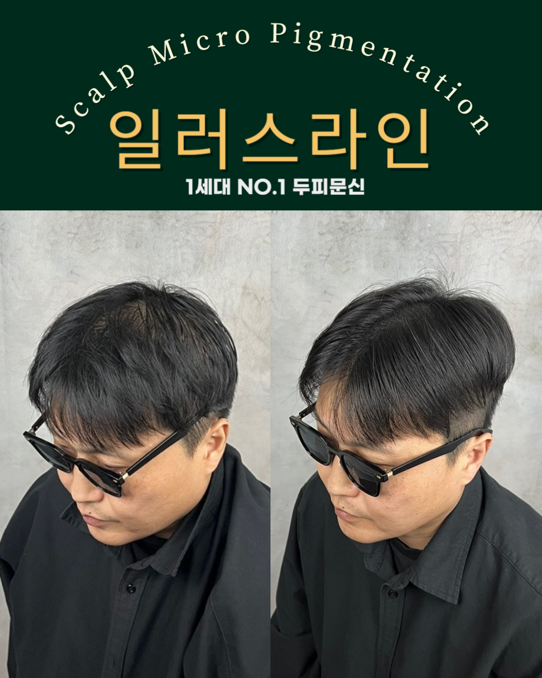 시술사례 이미지