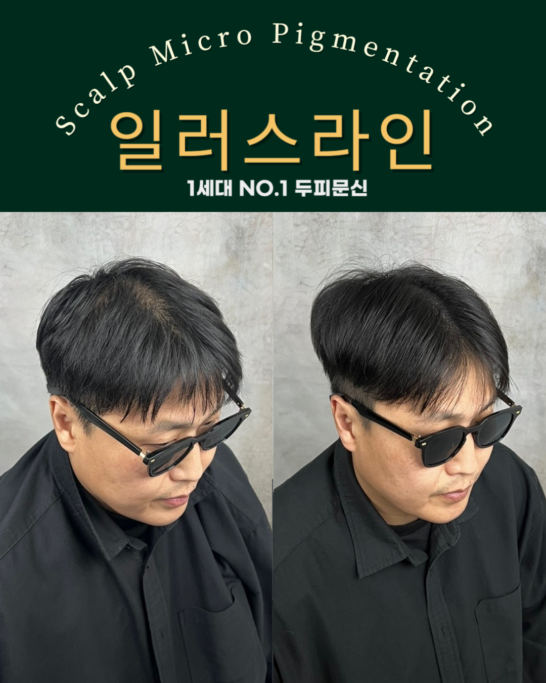 시술사례 이미지