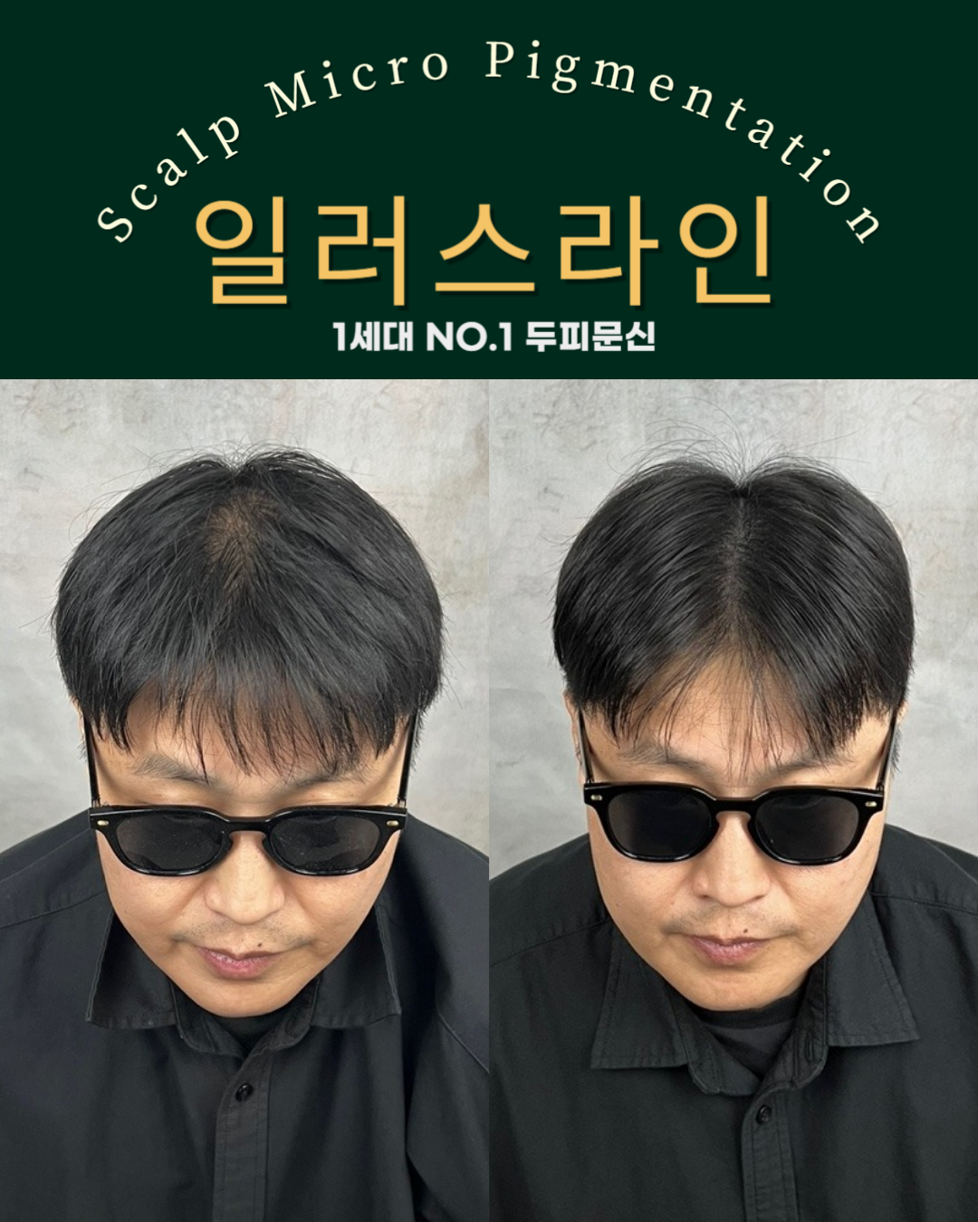 시술사례 이미지