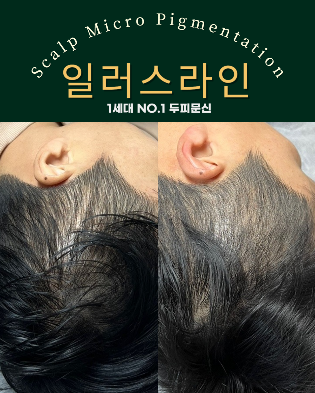 시술사례 이미지