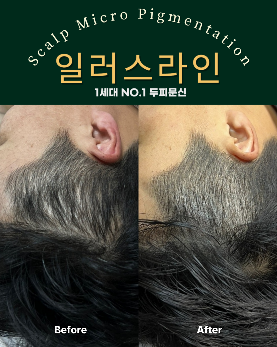시술사례 이미지