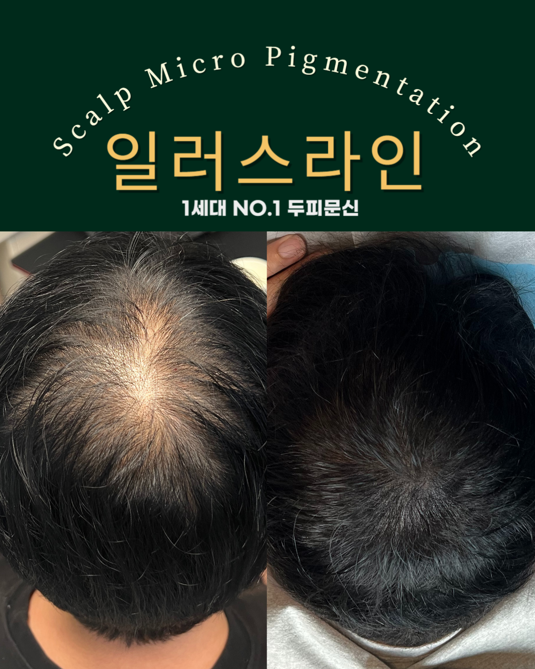 시술사례 이미지