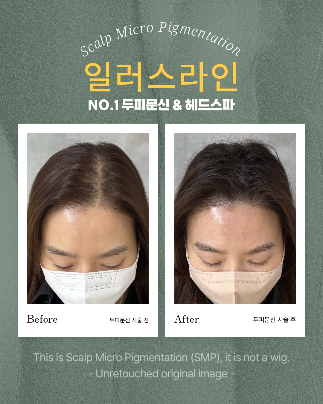 시술사례 이미지