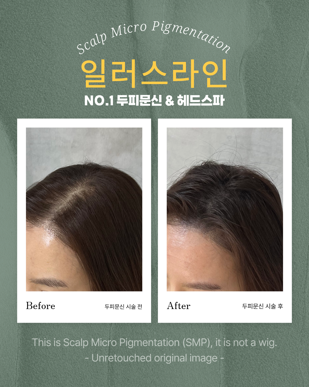 시술사례 이미지