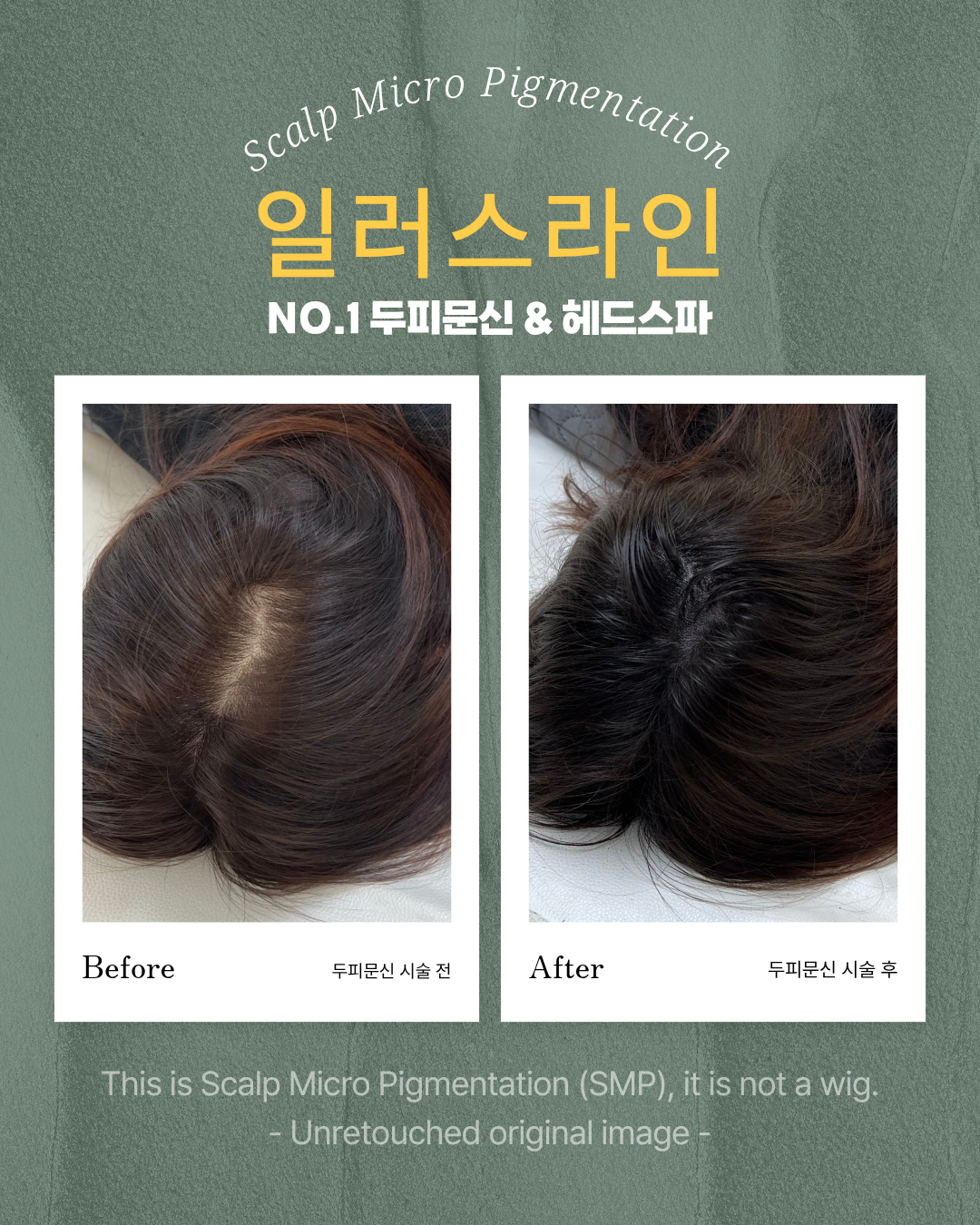 시술사례 이미지