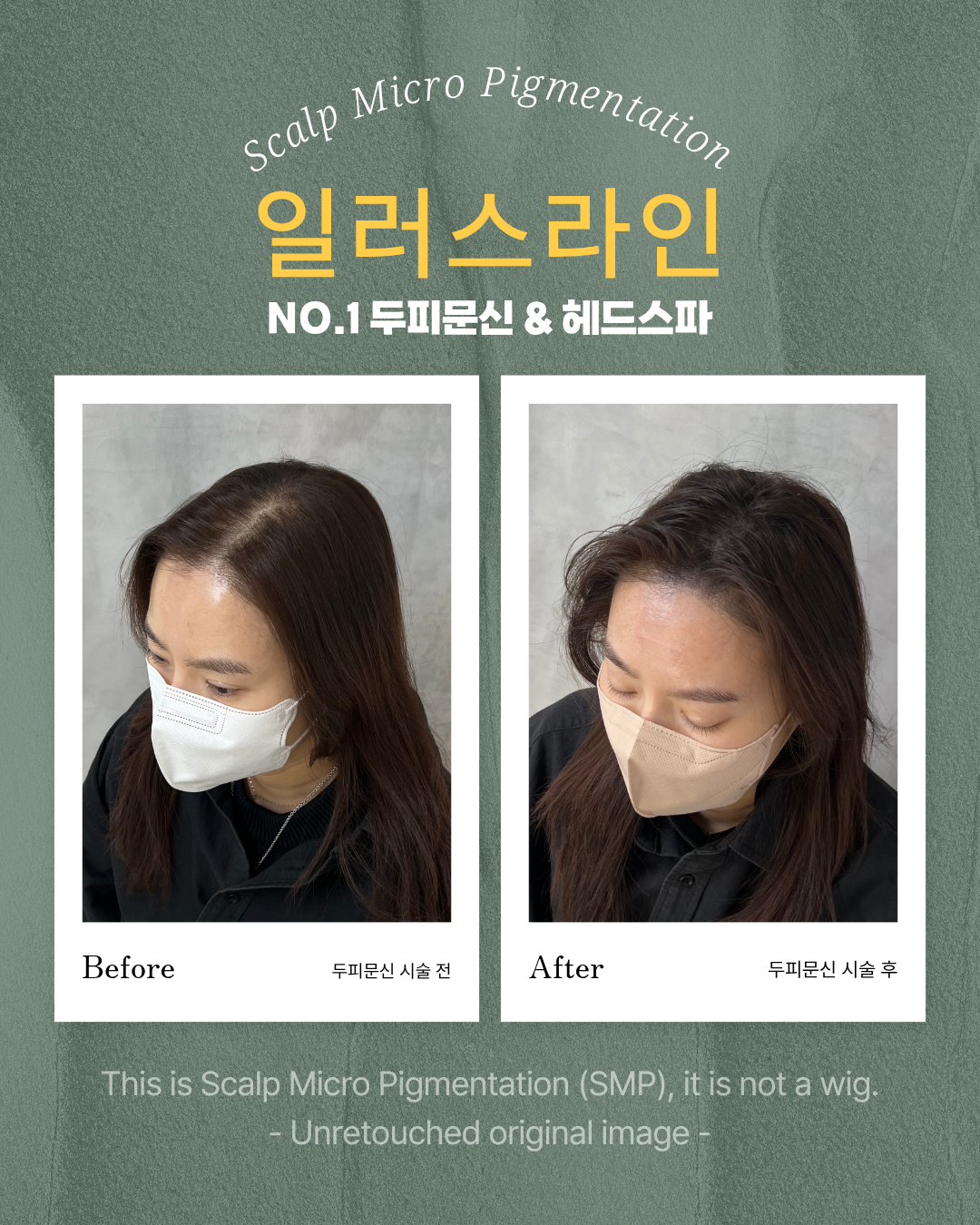 시술사례 이미지