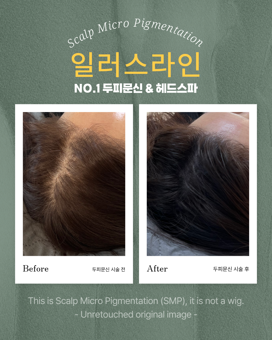 시술사례 이미지